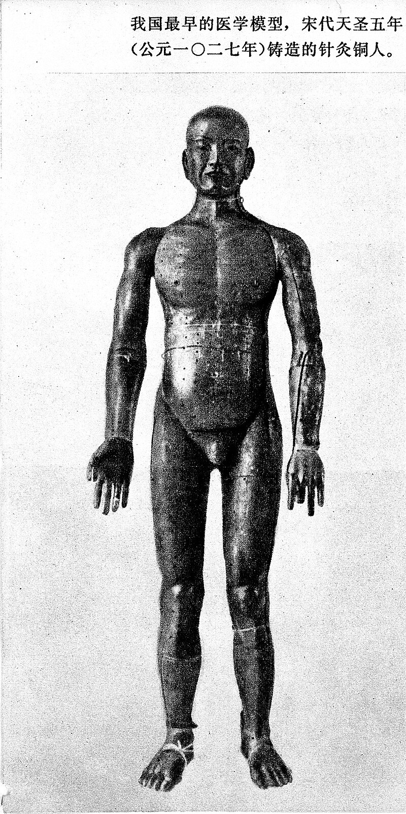 Bronze acupuncture figure showing meridian lines and acupoint locations used for traditional Chinese medical education